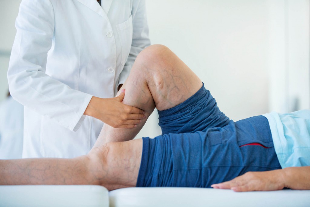 Conheça 3 riscos da má circulação sanguínea nas pernas!
